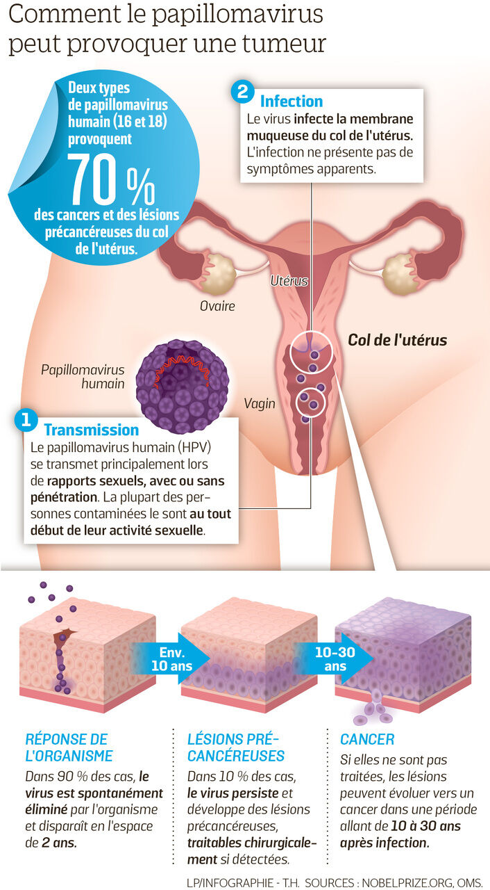 Vaccin hpv femme 30 ans, APPEL À LA RAISON, Vaccin papillomavirus apres 20 ans