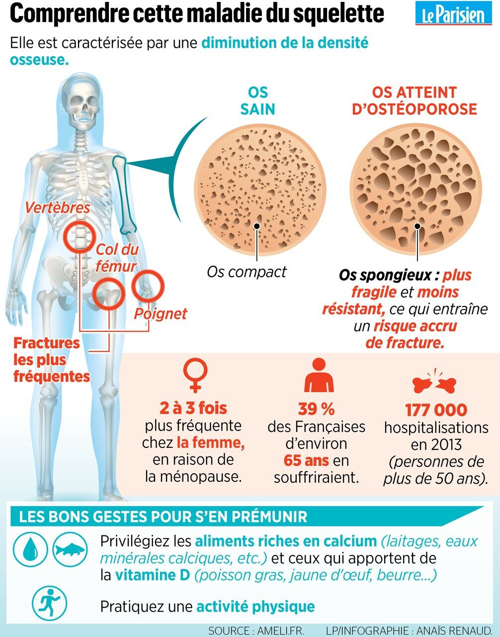 comment reduire les risques d osteoporose le parisien