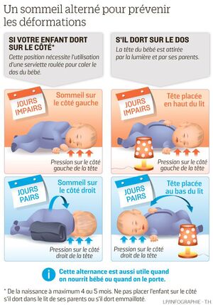 Une association alerte face à «l'épidémie» de têtes plates chez les  nourrissons - Le Parisien